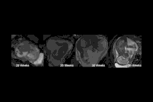 Tại sao em bé trong bụng mẹ lại đạp?