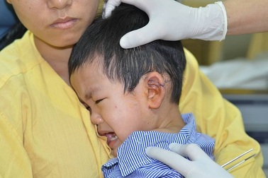 Một bé trai 3 tuổi bị tôn cắt ngang vành tai