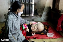 Thương người vợ còm cõi nuôi chồng và con bại não, bữa cơm nào cũng khóc