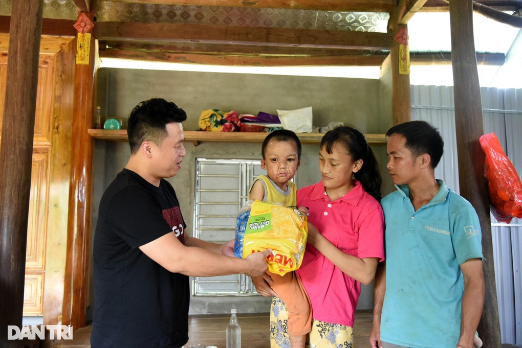 Cậu bé bị bỏng lết trên nền nhà, sau 3 lần phẫu thuật giờ đã đi học - 3 Cậu bé bị bỏng lết trên nền nhà, sau 3 lần phẫu thuật giờ đã đi học - 3