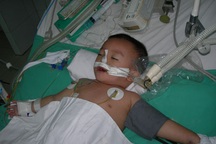 Sự sống nguy kịch của bé 21 tháng tuổi bị nhiễm trùng huyết