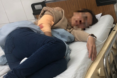 Điều tra nhóm côn đồ bịt mặt chém trọng thương chủ quán cà phê