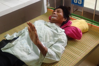 Phát hiện 2 cha con ruột mắc bệnh viêm da dày sừng lòng bàn tay chân