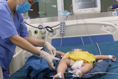 Lấy nhầm chai cồn rửa mũi cho con, bé 8 tháng tuổi phải lọc máu