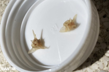 TPHCM: Bà nấu cháo lươn cho ăn, bé gái 1 tuổi phải vào phòng mổ 7 lần