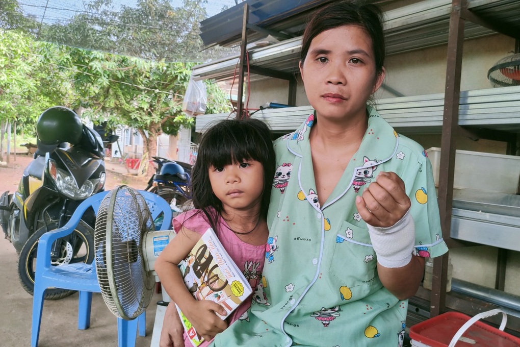 Mẹ cam chịu tật nguyền sau tai nạn thảm khốc để lấy tiền chữa trị cho con - 1 Mẹ cam chịu tật nguyền sau tai nạn thảm khốc để lấy tiền chữa trị cho con - 1