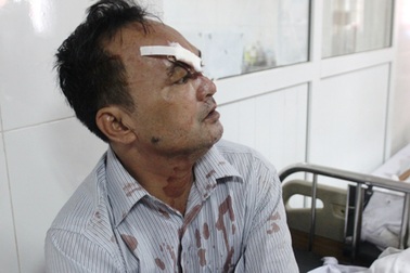 Du khách kể lại giây phút hoảng loạn đập cửa kính xe thoát thân