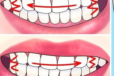 Làm thế nào để không nghiến răng khi ngủ?