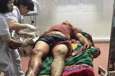 Mâu thuẫn tiền làm công, người đàn ông bị chém trọng thương