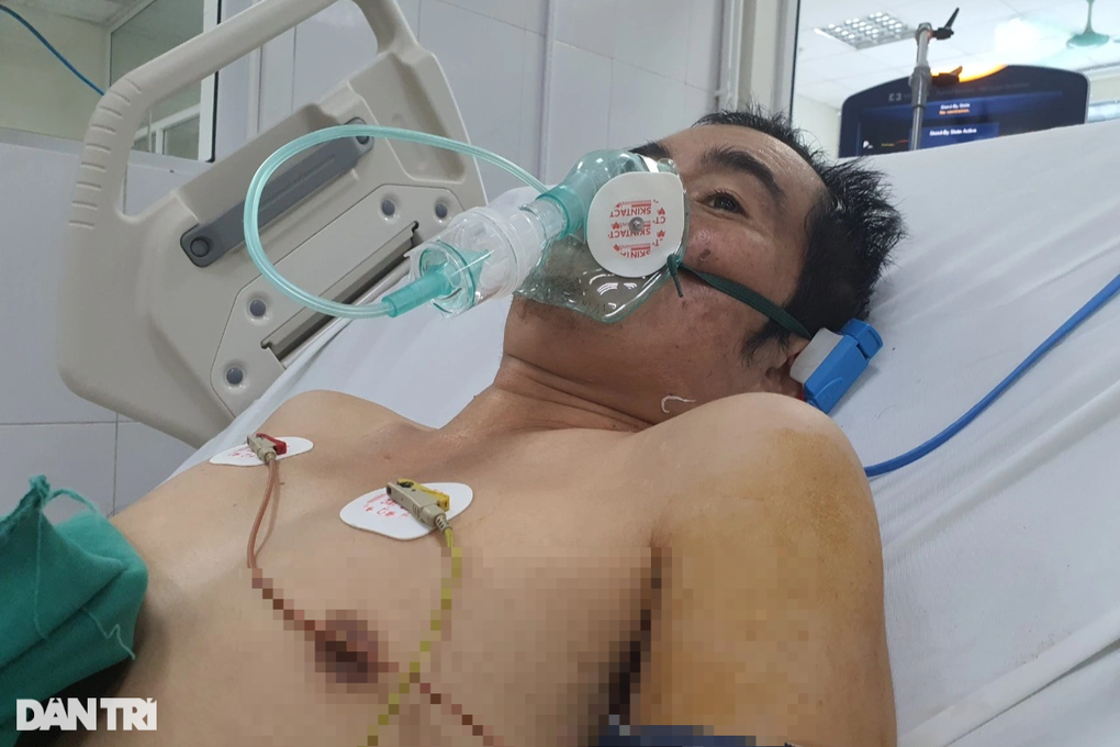 Đau lòng cảnh sống không bằng chết của người cha bị cắt cụt chân tay - 4 Đau lòng cảnh sống không bằng chết của người cha bị cắt cụt chân tay - 4