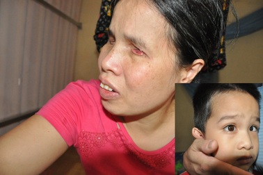 Xót xa bố mẹ mù khẩn thiết cầu xin cứu mạng con trai mắc bệnh hiểm nghèo