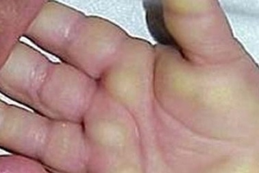 Sẽ nghiên cứu “bệnh lạ” ở Quảng Ngãi