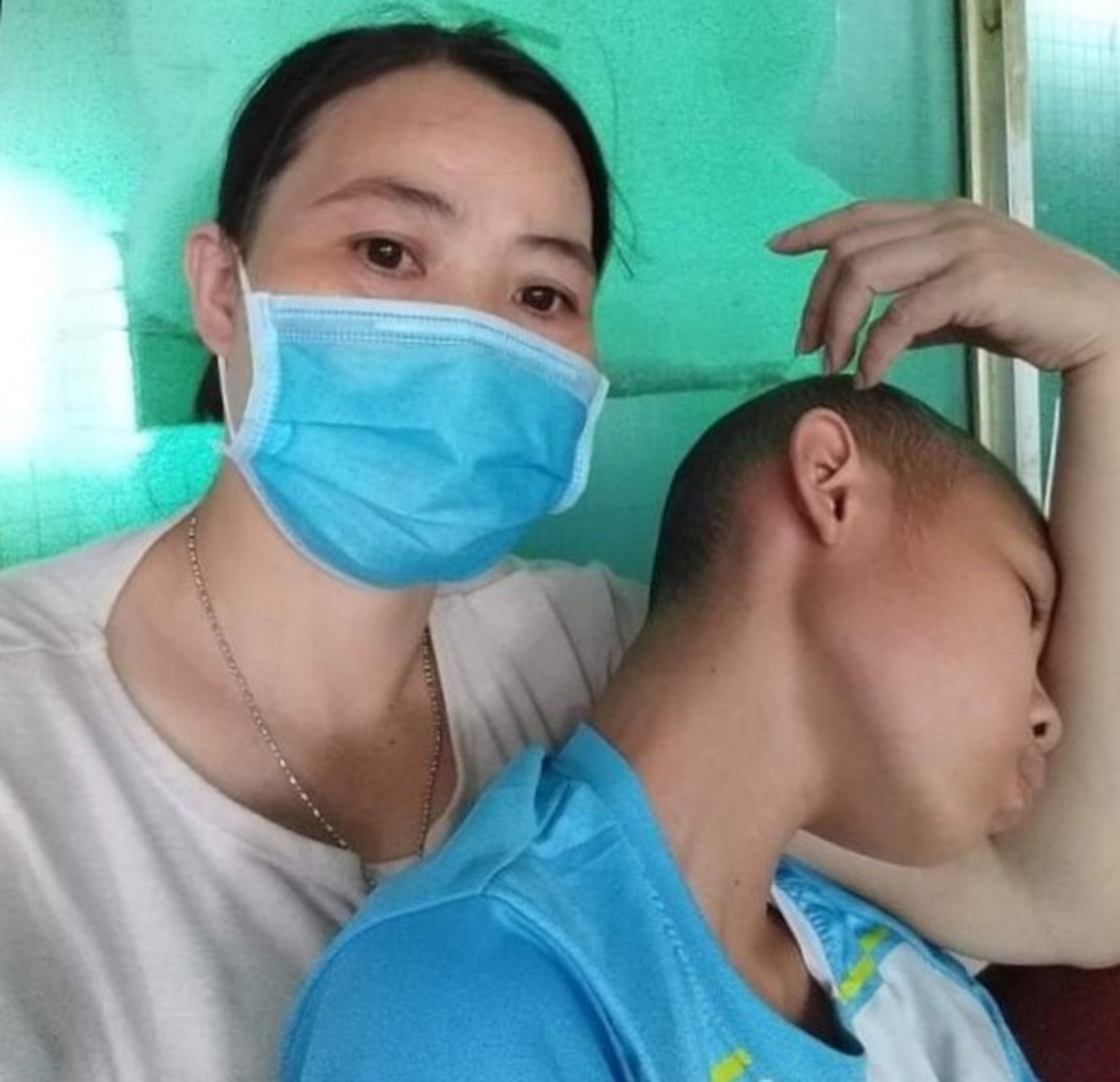 Thương cậu bé mồ côi 14 tuổi chỉ nặng 28kg vì khối u khủng ăn hết bên đùi - 5 Thương cậu bé mồ côi 14 tuổi chỉ nặng 28kg vì khối u khủng ăn hết bên đùi - 5