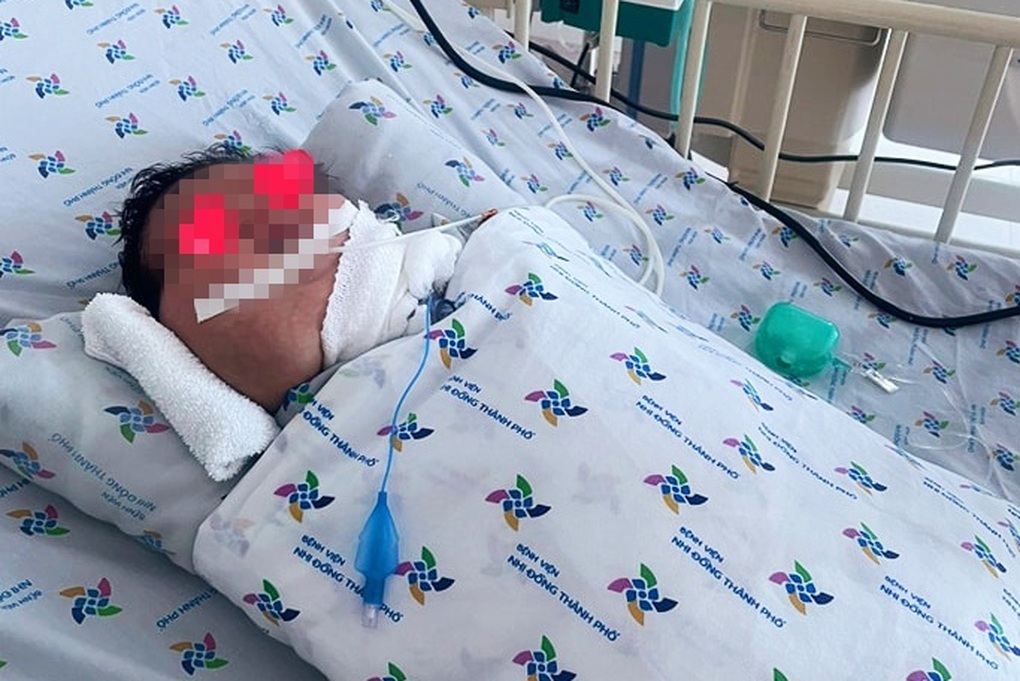 TPHCM: Bé sơ sinh mang khối bướu khổng lồ ở cổ, to như chiếc đầu thứ hai - 1 TPHCM: Bé sơ sinh mang khối bướu khổng lồ ở cổ, to như chiếc đầu thứ hai - 1