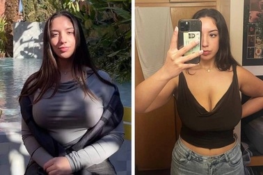 Có vòng một quá khổ, nữ sinh đau khổ vì bị miệt thị ngoại hình