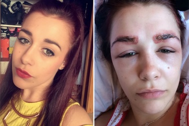 Nhập viện vì xăm lông mày, nhuộm tóc đón Tết