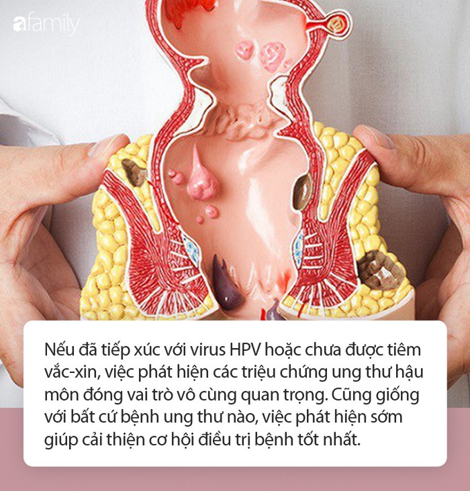 Tỷ lệ ung thư hậu môn đang gia tăng ở Hoa Kỳ: Làm thế nào để phát hiện triệu chứng sớm của bệnh? - Ảnh 1.