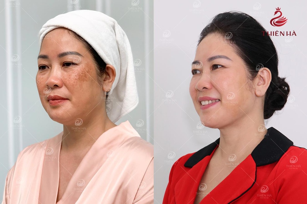 Có gì ở Viện thẩm mỹ được Sao Việt ưa chuộng? - 4 Có gì ở Viện thẩm mỹ được Sao Việt ưa chuộng? - 4