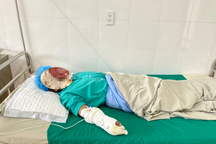 Hỏa hoạn tại đám tang, 4 người trong một gia đình bỏng nặng