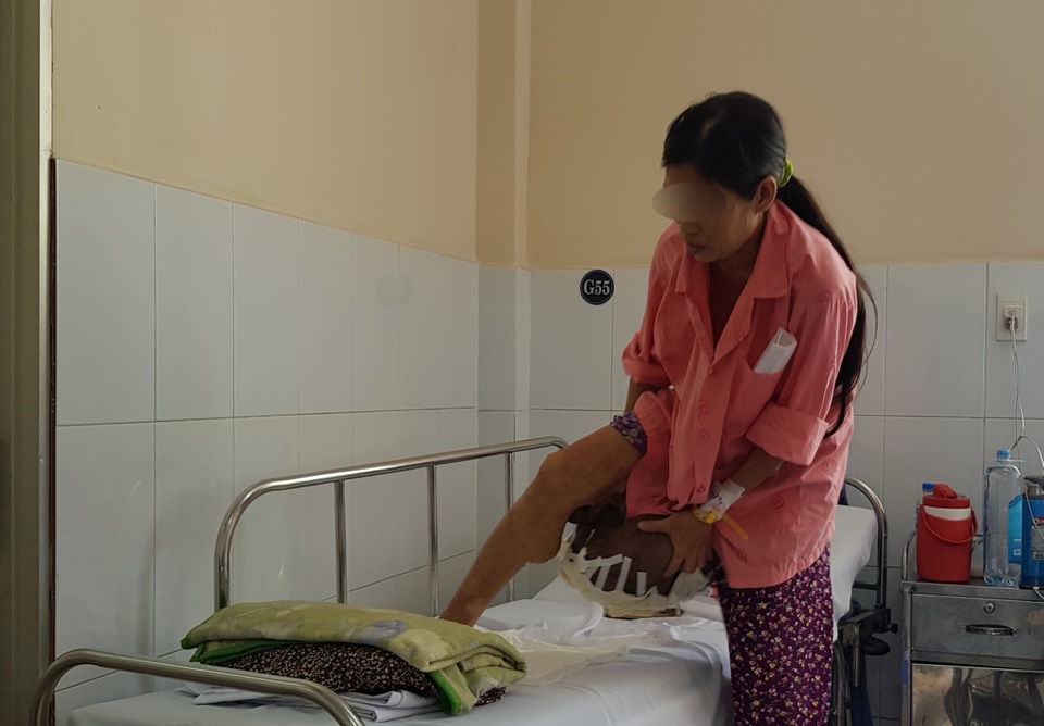 Mang khối bướu khổng lồ vẫn liều mình sinh con để… dưỡng già - 1 Mang khối bướu khổng lồ vẫn liều mình sinh con để… dưỡng già - 1