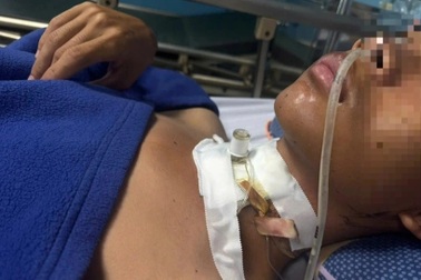 Nam thanh niên bị đứt lìa khí quản vì vướng vào dây điện giữa đường