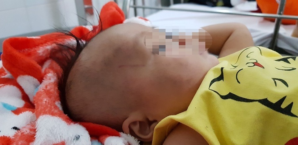 Bé 4 tháng tuổi nghi bị cha bạo hành gãy chân, xuất huyết não - 2 Bé 4 tháng tuổi nghi bị cha bạo hành gãy chân, xuất huyết não - 2