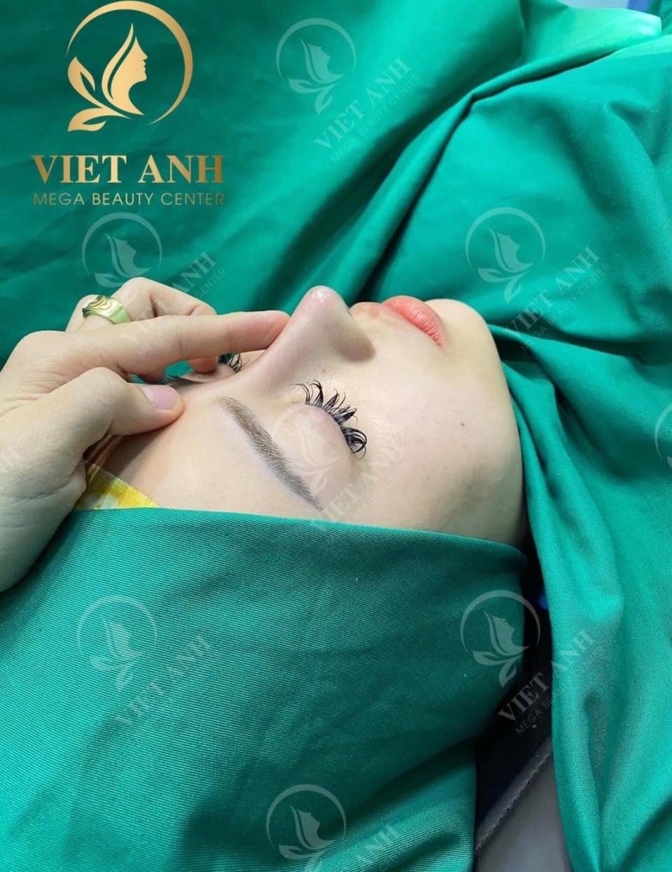 Lực lượng thanh tra bị cơ sở thẩm mỹ chui khóa cửa, chặn đường - 2 Lực lượng thanh tra bị cơ sở thẩm mỹ chui khóa cửa, chặn đường - 2