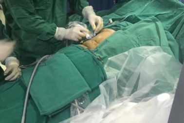 7 dấu hiệu cảnh báo sỏi mật