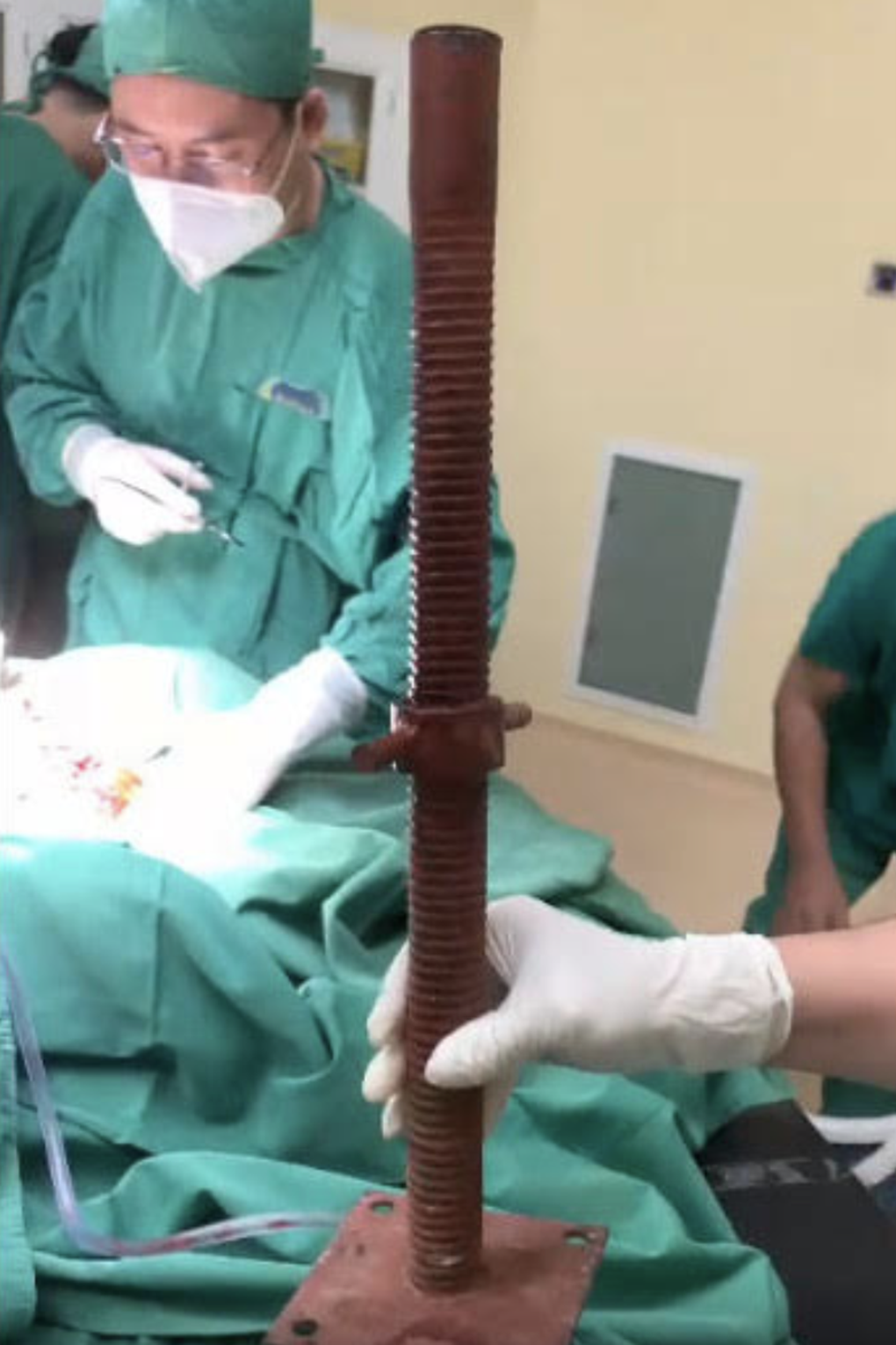 Ngã giàn công trình, nam thanh niên bị ống sắt đâm xuyên cổ kinh hoàng - 3 Ngã giàn công trình, nam thanh niên bị ống sắt đâm xuyên cổ kinh hoàng - 3