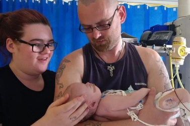 Sức sống kỳ diệu của bé sơ sinh chống chọi bệnh tim