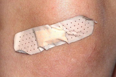 Tại sao vết thương lành nhanh hơn vào ban ngày?