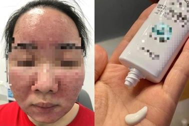 Tin kem chống nắng nổ trên mạng xã hội, mặt nữ sinh "nở hoa"