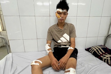 Quái xế đâm đại úy CSCĐ: Vi phạm giao thông nên lao qua chốt để bỏ chạy