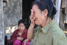 Bị ấu trùng giun đũa chó, người đàn bà khốn khổ không được đi viện vì phải ở nhà chăm 2 em thần kinh