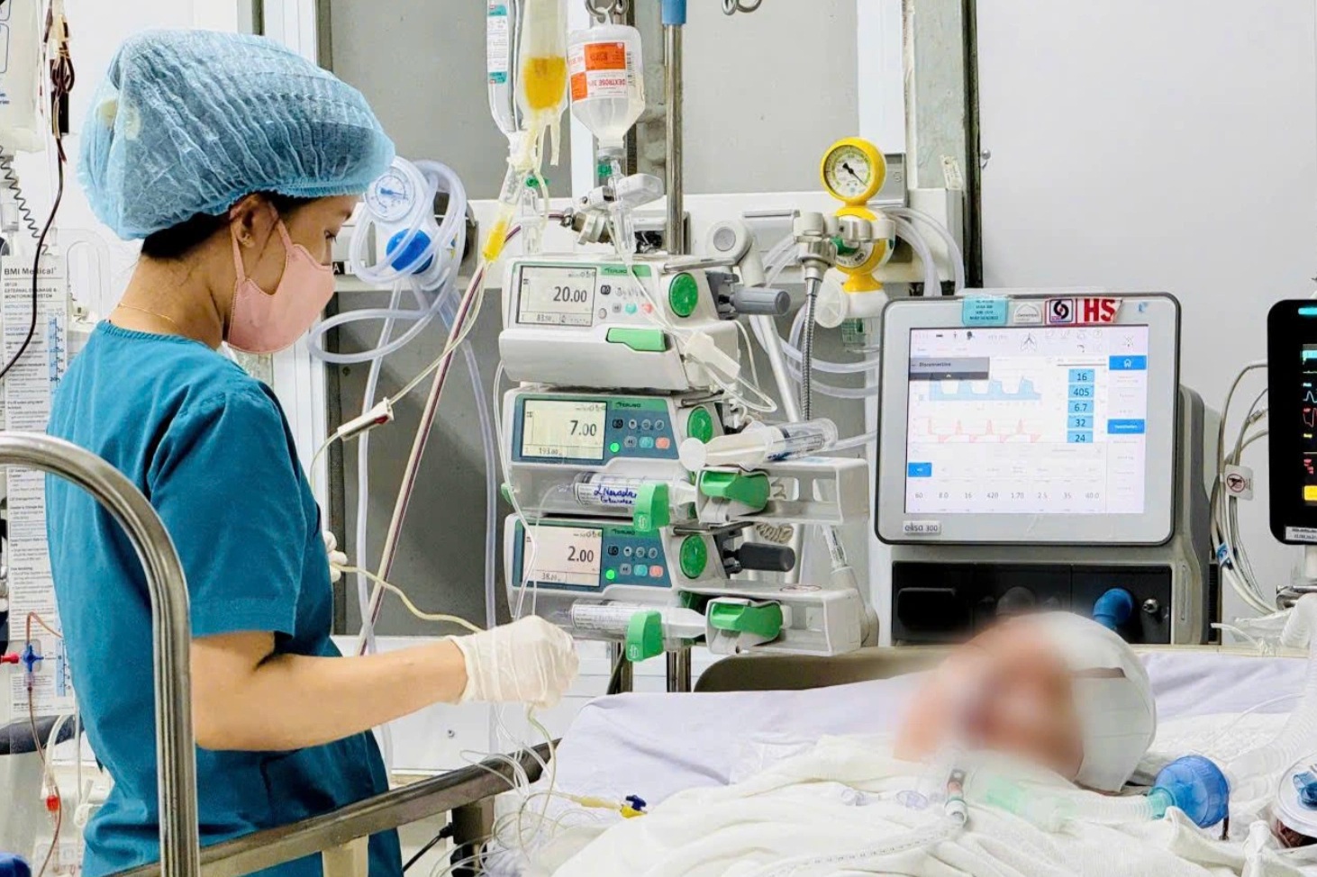Trắng đêm hồi sinh 3 sự sống nhờ tim và 2 thận của người hiến chết não - 1