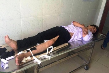 Tông CSGT trọng thương, 2 nam thanh niên cũng nhập viện