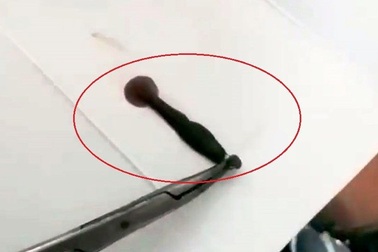 Đi tắm khe suối ngày lễ, 2 người bị đỉa chui vào mũi