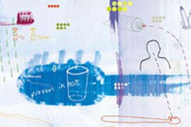 Vì sao bị sâu răng?