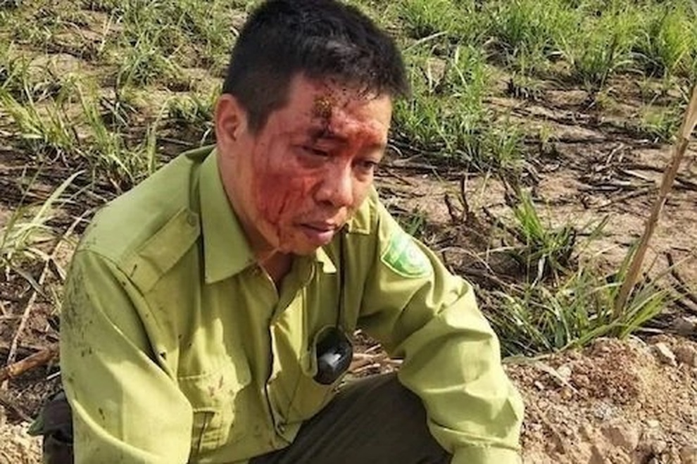 Kiểm lâm bị đánh _ Đắk Lắk _ CTV.jpeg Kiểm lâm bị đánh _ Đắk Lắk _ CTV.jpeg