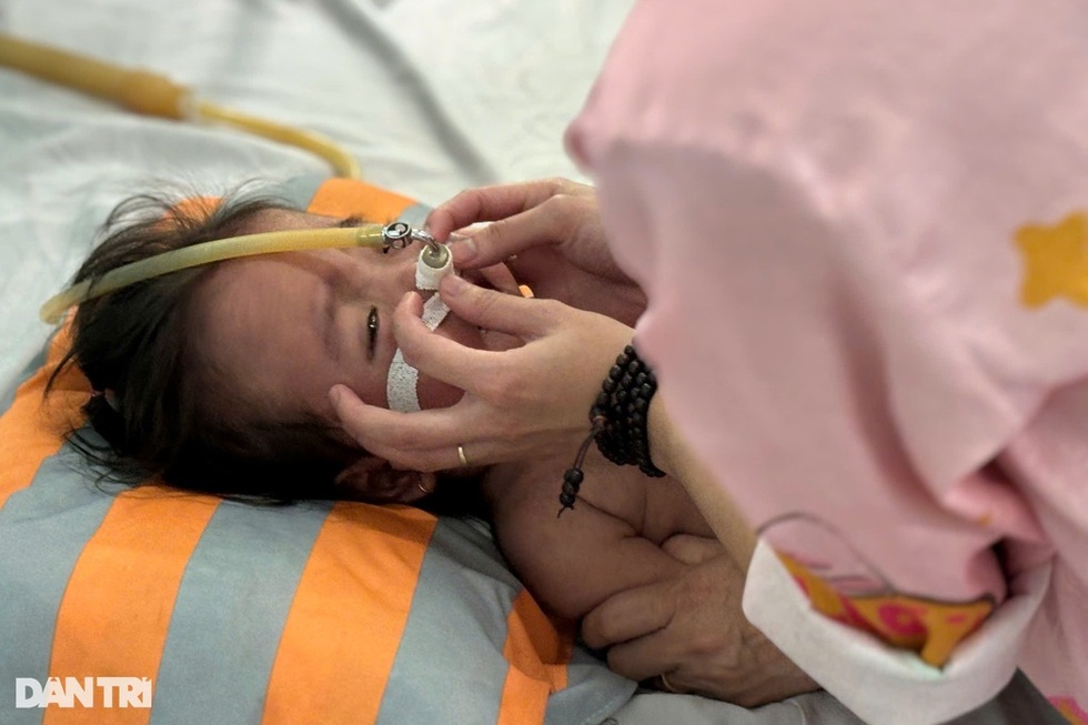 Bệnh sởi quay lại trên toàn cầu, Việt Nam hiện trong chu kỳ bùng phát dịch - 8 Bệnh sởi quay lại trên toàn cầu, Việt Nam hiện trong chu kỳ bùng phát dịch - 8