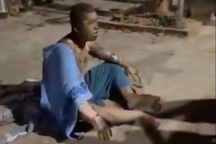 3 người bị bỏng nặng sau tiếng nổ lớn trong khu nhà trọ