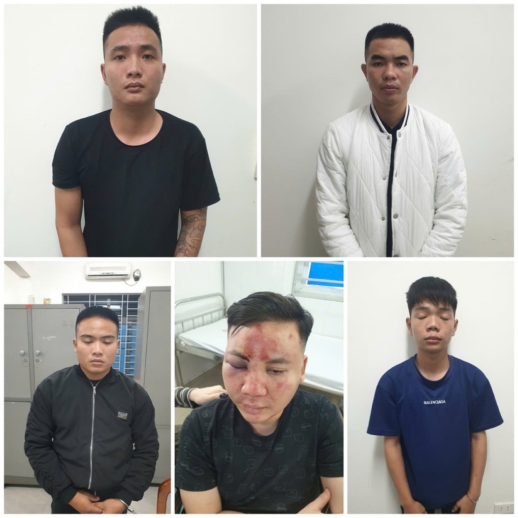 Xe điên lao vào giữa đám đông: Có dấu hiệu nhiều tội danh? - 2