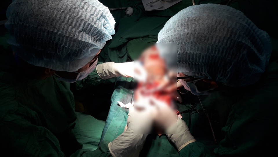 Cây cổ thụ bật gốc đè người đi đường chấn thương sọ não, gãy nát xương - 2 Cây cổ thụ bật gốc đè người đi đường chấn thương sọ não, gãy nát xương - 2