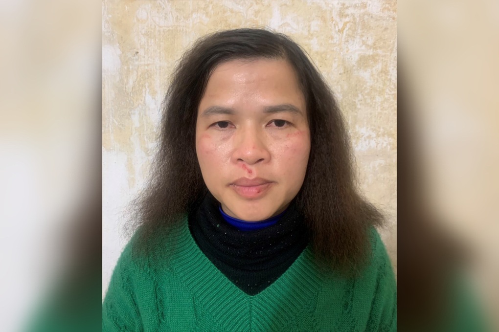 Khởi tố đối tượng đâm nữ tiểu thương tử vong - 1 Khởi tố đối tượng đâm nữ tiểu thương tử vong - 1