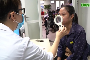 Mùa bùng phát loài kiến “độc tính mạnh hơn rắn hổ mang” ở Hà Nội