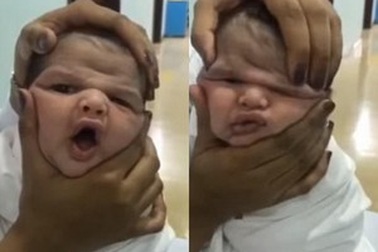 Y tá bị đuổi việc vì đùa nghịch với gương mặt em bé mới sinh