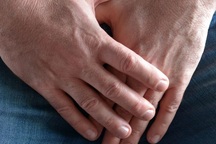 Có những bất thường này ở da bao quy đầu, nam giới nên đi khám