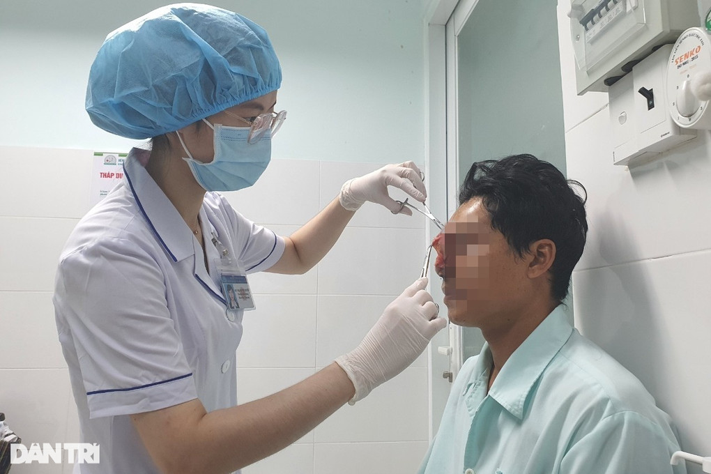 Người đàn ông 33 tuổi bị bạn nhậu cắn đứt mũi - 3 Người đàn ông 33 tuổi bị bạn nhậu cắn đứt mũi - 3