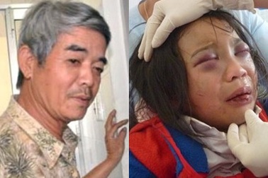Bắt khẩn cấp cha nuôi hành hạ dã man bé gái 10 tuổi 