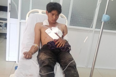 Nổ mìn tự chế khi đi đánh cá, 2 thanh niên bị thương nặng